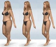 Weight loss